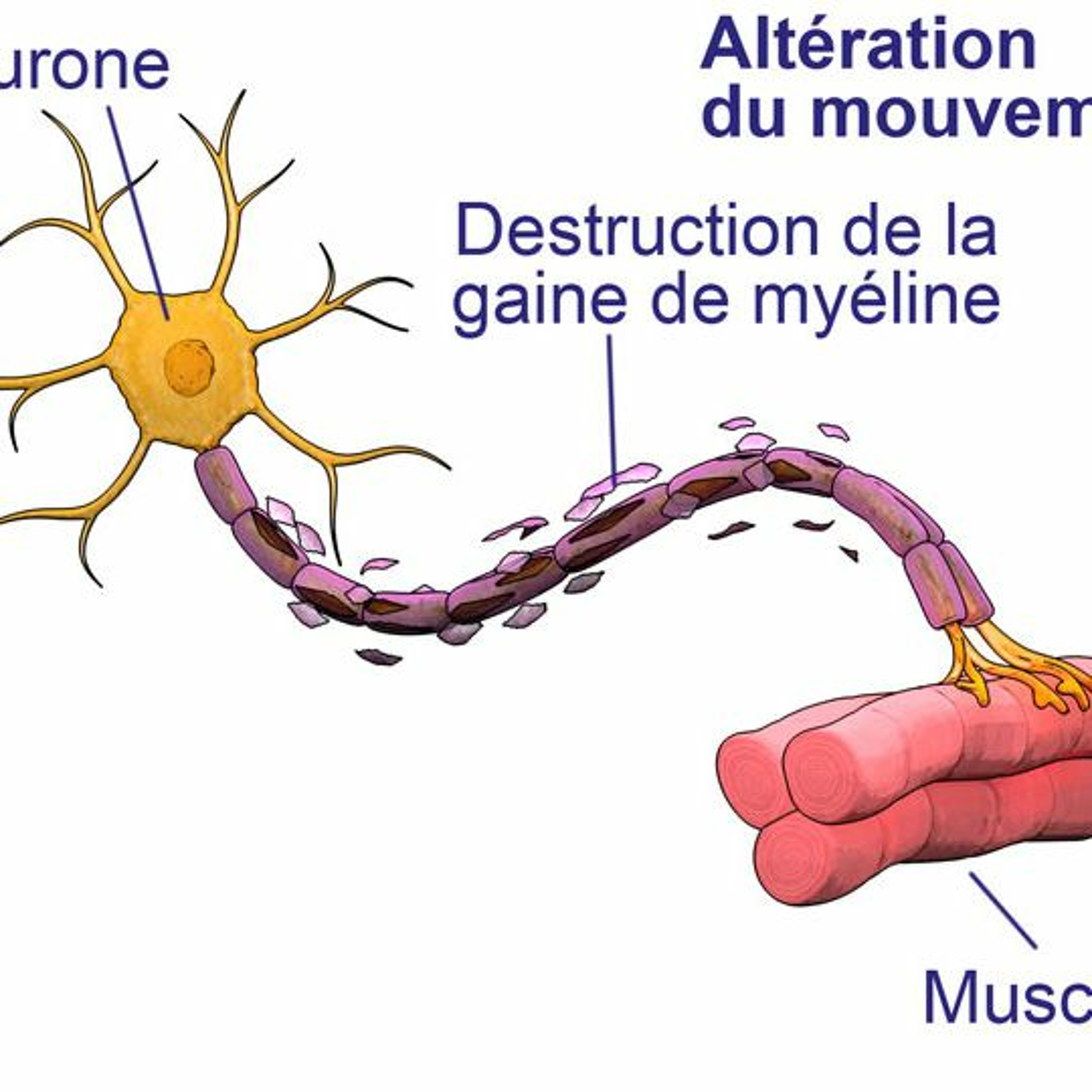 Vers une autre approche des maladies