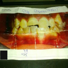 1 year later - 14/15 P1/5: afeMaleTraiT / TheuglyduckliNg