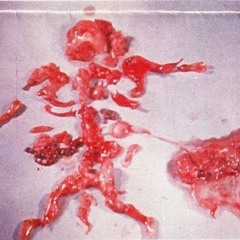 Harry Potter E Gli Orrori Dell'Aborto Involontario INSTRUMENTAL