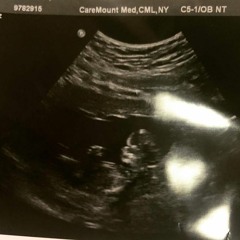 Around 4 You (Aubree)