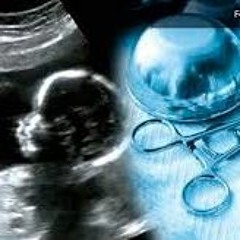 Abort V1.0