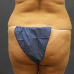 Butt (Prod. L'indecis)