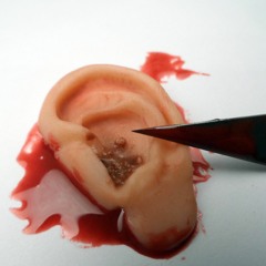 Ear Infection