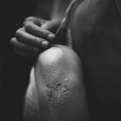 Serkan | Bile Bile (Kırgın Çiçekler)