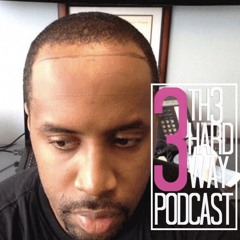 EPISODE 9- Got hairline?