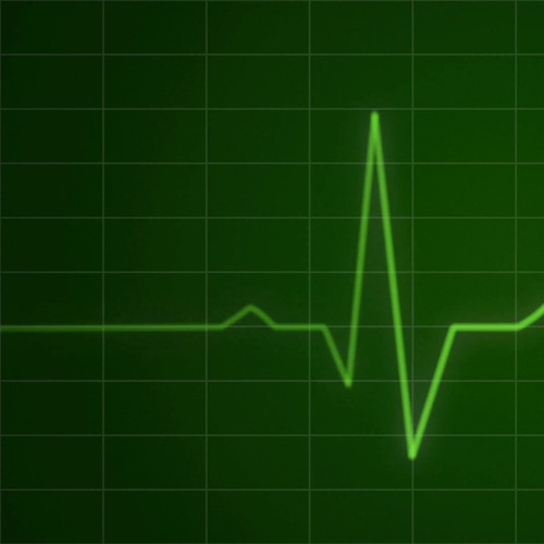 YourHeart - 140BPM