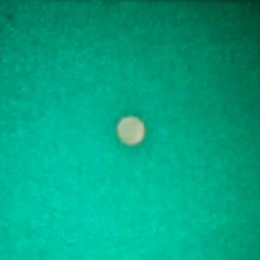 Métadire - Septet au Petit Balcon