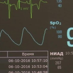 Prod.Meyson - Пульс