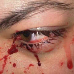 wound