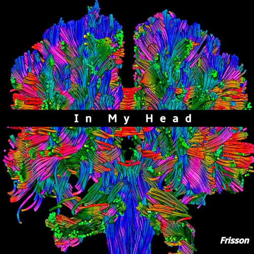 In My Head