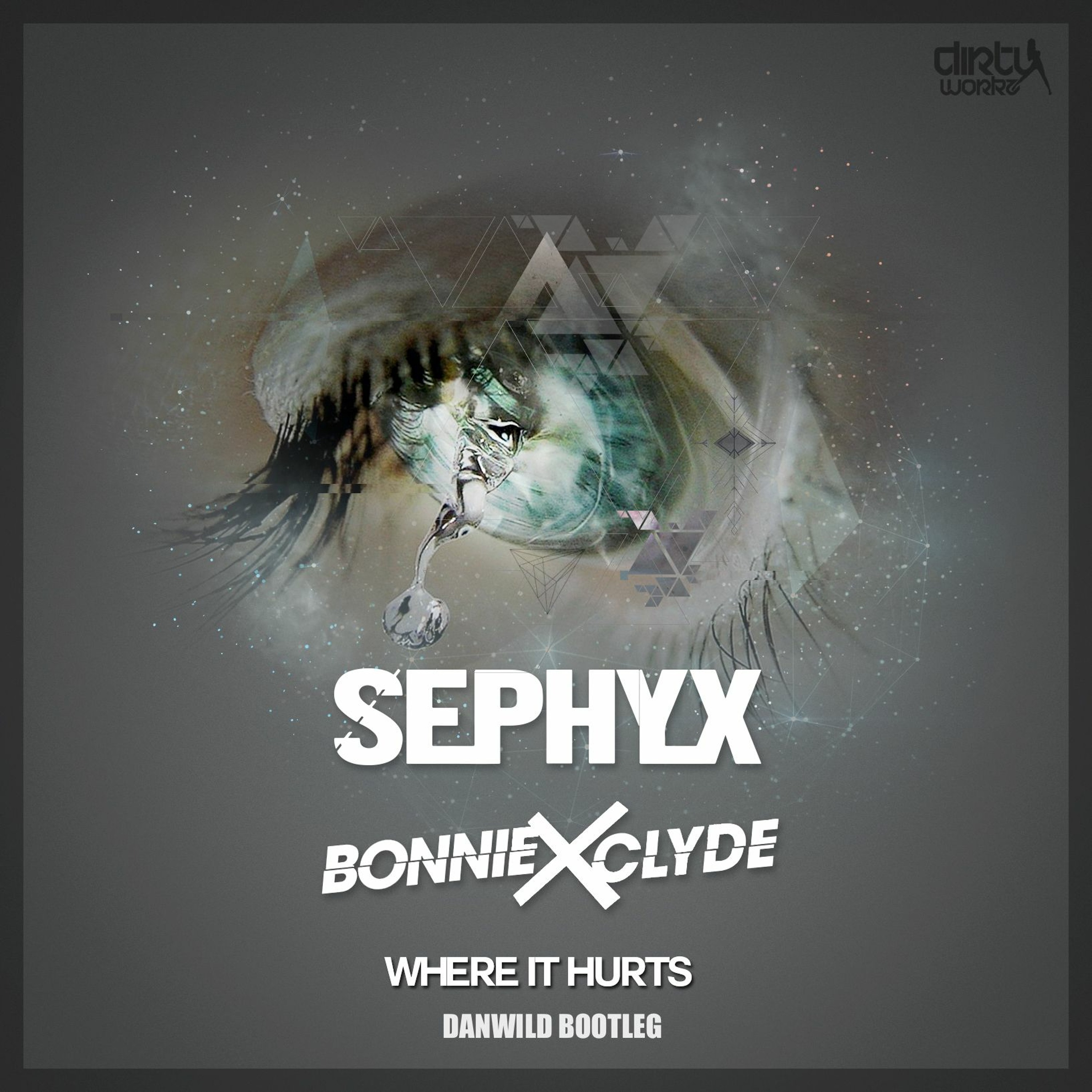 (FREE DOWNLOAD) Where It Hurts (Dan Wild Remix)BONNIE X CLYDE episode artwork