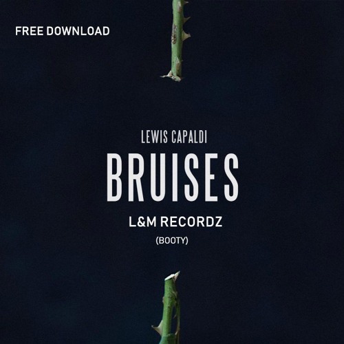 L&M Recordz - Bruises