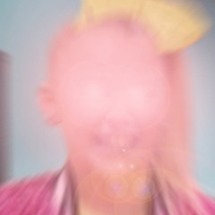The Disappearance of Jojo Siwa's Hairline
