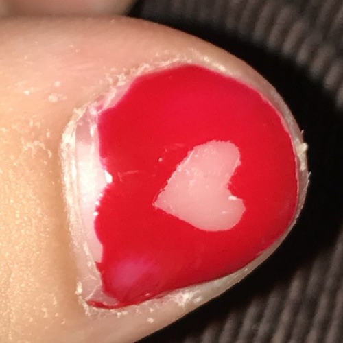 I'm the one still worrying