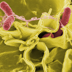 Understanding Antibiotic Resistant Bacteria