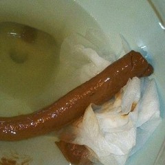 Грыжа Каловой Массы