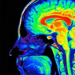 Brain On Drugs | Eddy Nygz x Mike Dinero x Stiles