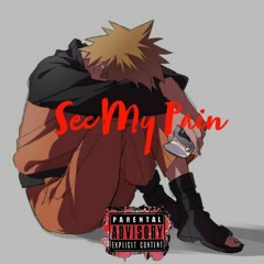 JBFrost X SeeMyPain