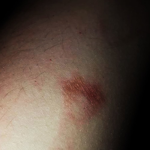 lighter burns (prod. CRCL) *lyrics in desc*