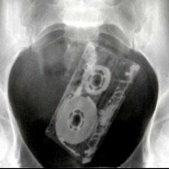 Terra Pete & 218 Over (Feinkost Paranoia) - Du Kannst Nixxx