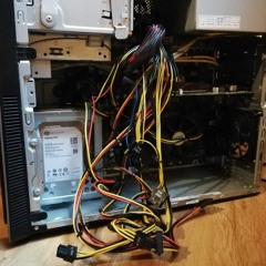 Open Heart Surgery