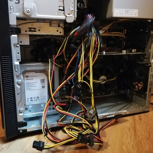 Open Heart Surgery