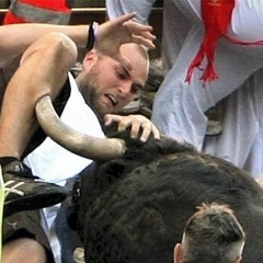 Rush Limbaugh's Disgusting Ass Hairs