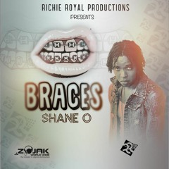 Shane O - Braces