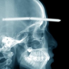 I AM BACK ..... M - Fuckers   POTCAST -- dezember __ XTREM WAR