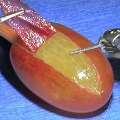 they did surgery on a grape