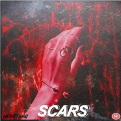 SCARS