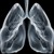 Artwork for Freeze your lungs like a Frozen Treat