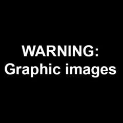 Dblack Ft Teej Da Savage - Same Shit