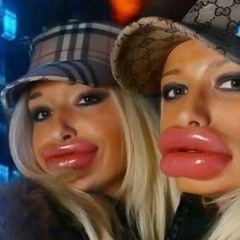 Botox