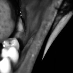 LIVING IS WHAT THEY CALL HELL