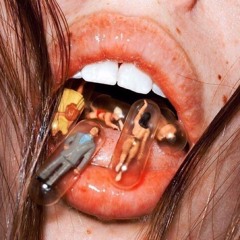 concussion