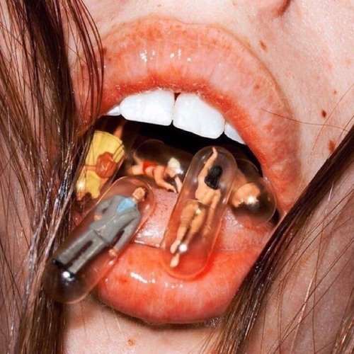 concussion