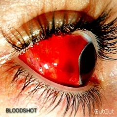 Bloodshot (Prod. Khroam x Bando Dali)
