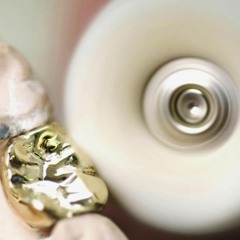 Edel bis vollverblendet