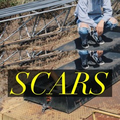 SCARS