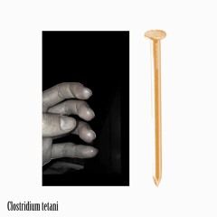 Clostridium tetani