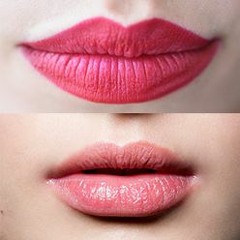 تجربة افضل طبيب مع ليزر توريد الشفايف - الفوائد و الاضرار وأهم المعلومات