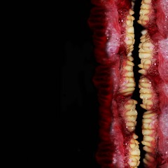 Bruises And Bleeding Hands