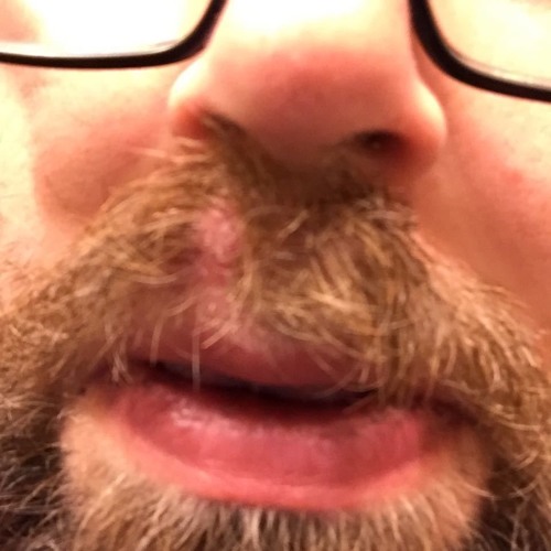 Ingrown Mustache Hair Blues By Tom Schnaars On Soundcloud Hear
