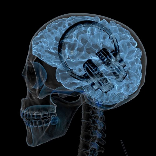 Underbelly - Brainmelt(Mike G Remix)
