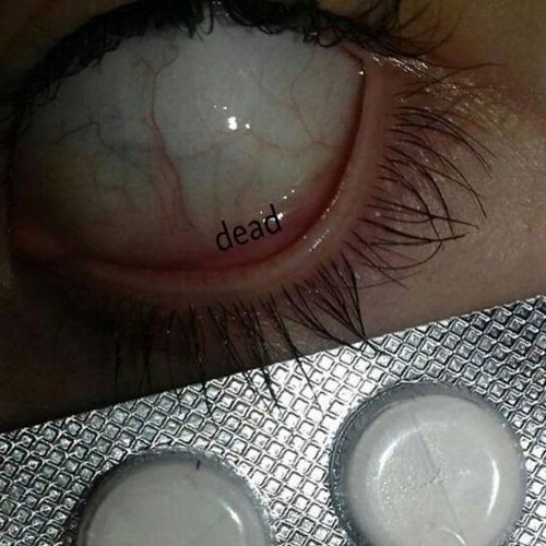 Stream coke snot | Listen to VELIAL SQUAD playlist online for free on ...