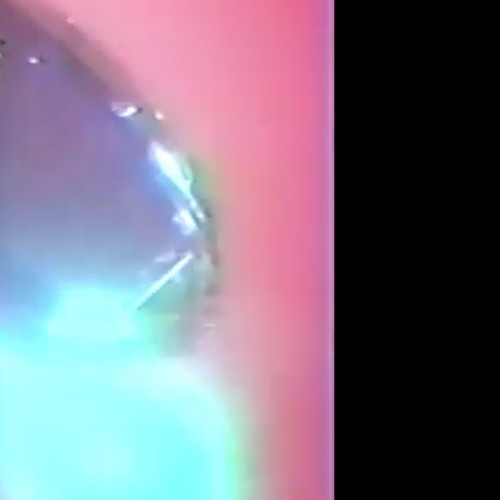 平     手     打     ち