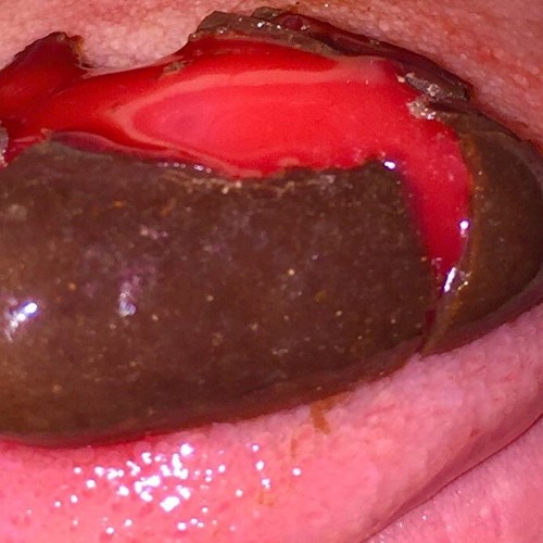 Know Now: Warm Hearts