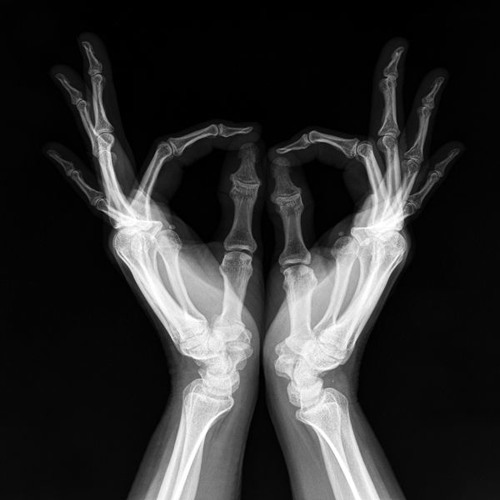 Any Other (Horse Feathers Theme)