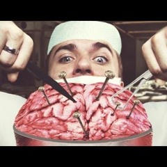 Brain Attack